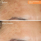 Vita-C Glycolic Serum