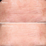 Youth Renewal Serum